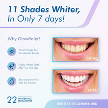 Load image into Gallery viewer, Teeth Whitening Kit 32 LED
