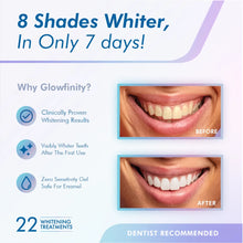 Load image into Gallery viewer, Teeth Whitening Pen