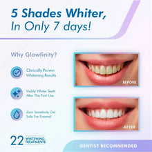 Load image into Gallery viewer, Teeth Whitening Gel